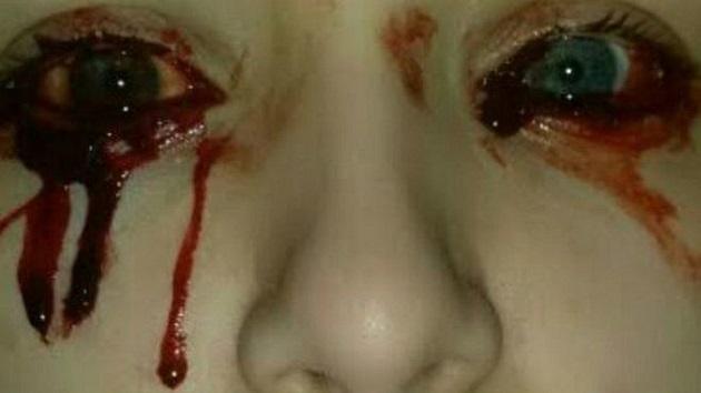O estranho caso da garota de belos olhos que chora sangue-0