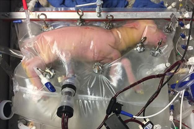 Conheça o útero artificial que pode salvar milhares de bebês prematuros-0