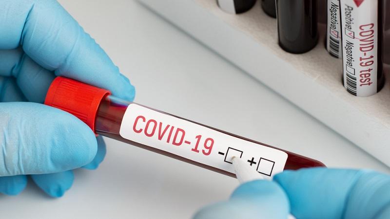 Mais de 550 mil pessoas já se recuperaram do coronavírus em todo o mundo-0