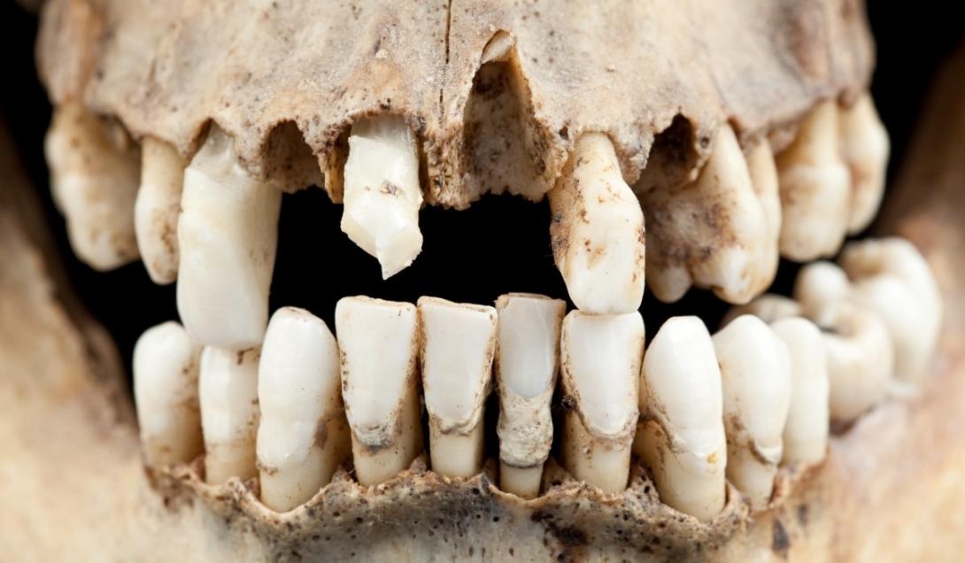 Bactérias dos dentes de neandertais podem ser usadas para desenvolver antibióticos-0